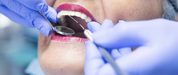 Best Emergency Dentist for Lost Fillings or Crowns in Poipu, HI